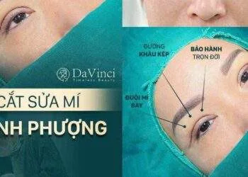 Cắt Sửa mí mắt tại Thẩm mỹ viện DaVinci có tốt an toàn và uy tín không?