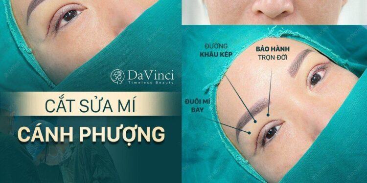 Cắt Sửa mí mắt tại Thẩm mỹ viện DaVinci có tốt an toàn và uy tín không?
