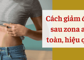 Đau sau zona và cách giảm đau an toàn, hiệu quả nhờ Bách Thống Vương