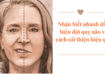 Nhận biết nhanh dấu hiệu đột quỵ não và cách cải thiện hiệu quả