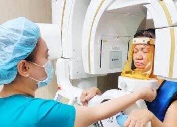 Implant cá nhân hóa tại Nha khoa Nhân Tâm – Giải pháp hoàn hảo cho trường hợp tiêu xương nghiêm trọng