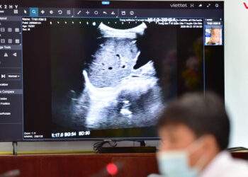 1.800 ca COVID-19 nặng được hội chẩn qua Telehealth