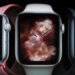 Tính năng đo điện tâm đồ được cập nhật vào Apple Watch