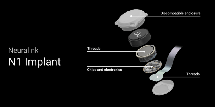 Neuralink: Điều khiển máy tính bằng não và hy vọng cho người mù